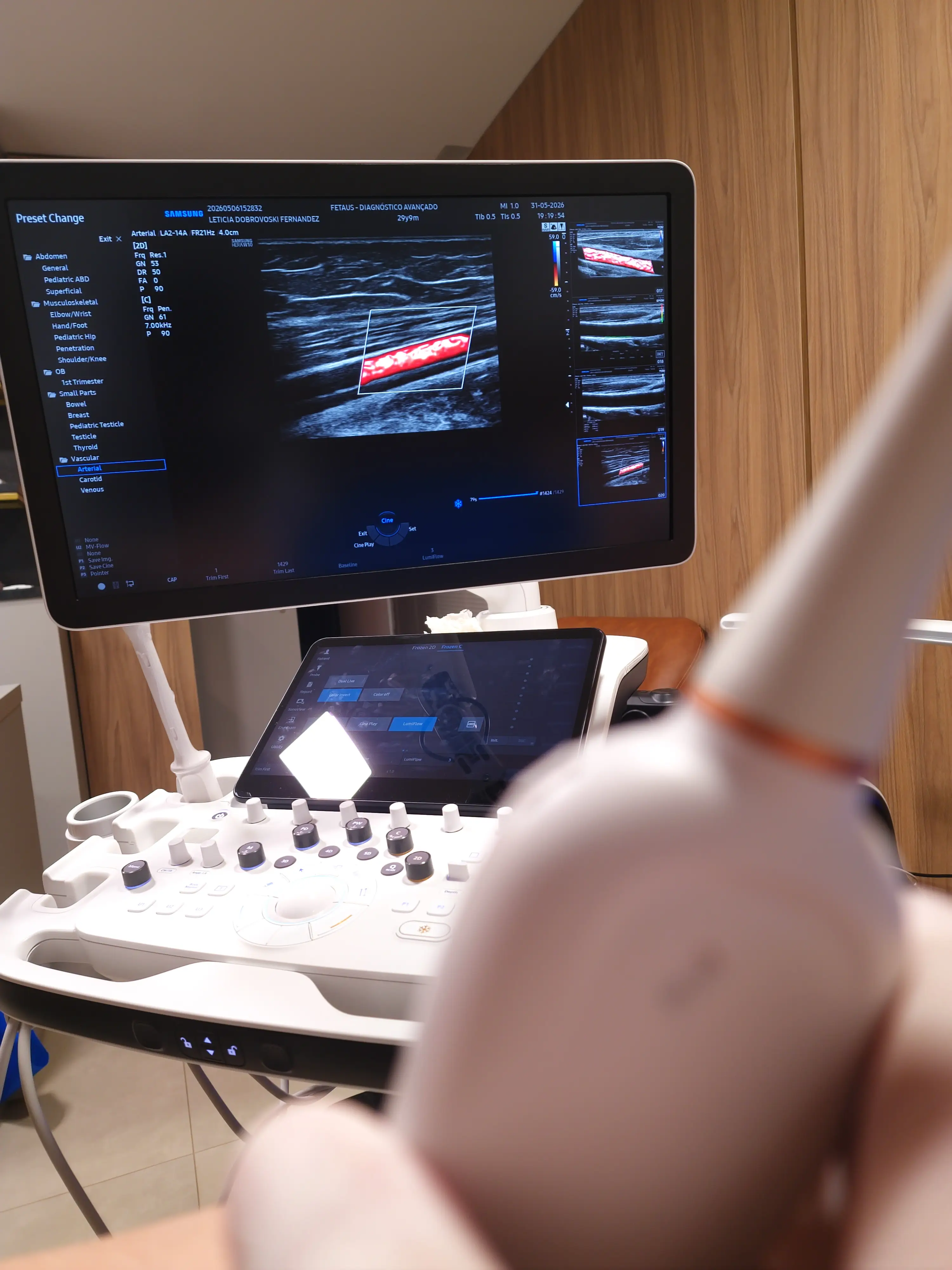 Exame Doppler Vascular
