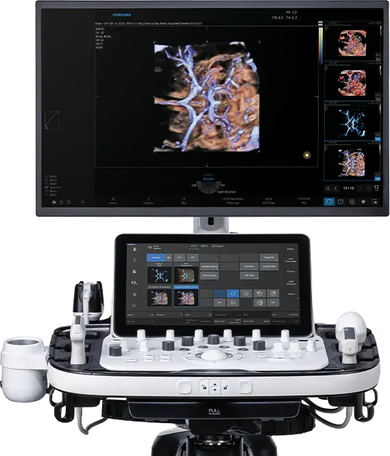 Equipamento de Alta Definição